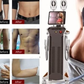 Uita de grasimea nedorita de pe abdomen sau fese, creste-ti si defineste-ti masa musculara fara efort, in doar cateva sedinte cu ajutorul dispozitivului  EMS Sculpt! Un protocol de tratament cu EMS RENASculpt echivaleaza cu 6 luni de tratamente regulate in sala de forta!