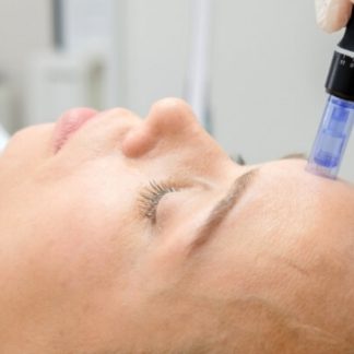 Vrei un ten curat, hidratat, lipsit de urme? Apeleaza la tratamentul cu Dermapen care ajuta la introducerea in piele de 3000 de ori a substantelor nutritive fata de cremele obisnuite. Rezultate garantate de la prima sedinta!