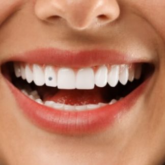 BIJUTERIE DENTARA (stras) diferite forme si culori doar 290 lei! Prinde oferta limitata si bucura-te de zambet stralucitor. Bijuteria dentara iti da un aer aparte care atrage toate privirile atunci cand zambesti! Oferta include consultatie, plan de tratament, bijuteria dentara si manopera lipire.