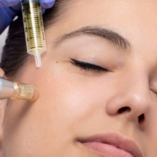 Vrei un ten curat, hidratat, lipsit de urme? Apeleaza la tratamentul cu Dermapen care ajuta la introducerea in piele de 3000 de ori a substantelor nutritive fata de cremele obisnuite. Rezultate garantate de la prima sedinta!